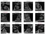 create and train dl model for medical image classification
