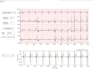 do biomedical signal and image processing