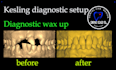 design kesling diagnostic setup