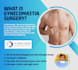 write plastic, cosmetic surgery, liposuction articles and blogs