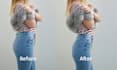 do body slimming, remove double chin and face reshape