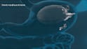 create best 3d medical animation and 3d modeling