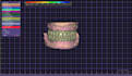 create dental artistry with exocad 3d