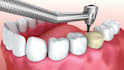 create a premium dental video, 3d medical animation, surgery animation