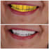 provide you excellent dental prothetic designs using exocad