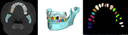 do medical image labeling,annotation,segmentation