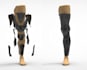 design custom body braces from 3d scan data