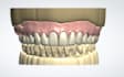 do denture design using 3shape