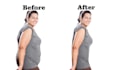 do body reshaping, body slimming, skinny, reduced double chine, face slim