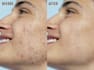do advance level photo editing and skin retouching