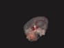 convert medical images to medical 3d model