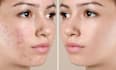 editing by adobe photoshop and retouching