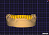 design anatomical mono, cutback and implant teeths