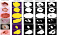 do medical image analysis using deep learning and python