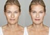 do retouch photo, bruises, tattoos, fly hair remove wrinkle, stretch