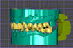 design digital dental models