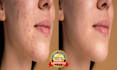retouch photo edit image with fast turnaround