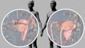 create esthetic medical and plastic surgery animations