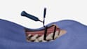 create 3d medical explainer video, 3d medical animation