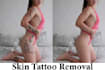 tattoo removal, skin retouching, and headshot editing