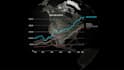 do globe animations like inside geopolitics