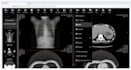 setup ohif dicom viewer for medical imaging