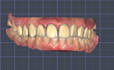 design full anatomic crowns