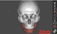 design new smiles in exocad