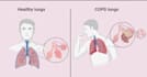 illustrate scientific, medical diagram graphical abstract, research presentation