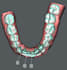 do clear aligner treatment planning as an orthodontist