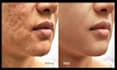 remove stray hair, flyaway, skin blemishes and portrait, headshot retouch