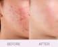 help you solve your skin problem being a dermatologist