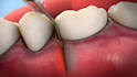 create professional 3d medical animation and surgical device animation