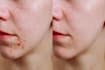 solve your skincare issue as a dermatologist