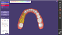 install v3,2 exocad elefsina for you
