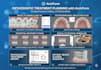 custom aligner treatment plans with 3d clincheck