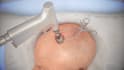 create realistic 3d medical animations 3d neurosurgery brain anatomy animation