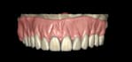 make dentures on exocad