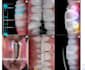 do a professional video editing on your dental cases