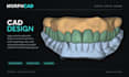 design dental crowns bridges and implants in exocad