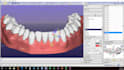 provide expert aligner treatment planning services