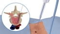 create scientifically accurate 3d medical animation, surgery video