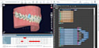treatment planning service for clear aligners