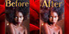 remove unwanted blemishes and perfect facial imperfections