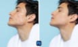 retouch your skin, remove your pimples, acne retouching