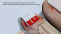 make 3d medical animation video