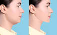 do pro face retouching, face and body slimming in 2 hours