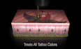 medical animation, 3d medical device explainer, surgery animation, anatomy video