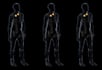 do 3d medical animation surgery animation anatomy biomedical explainer videos