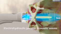 do medical animation product demonstration